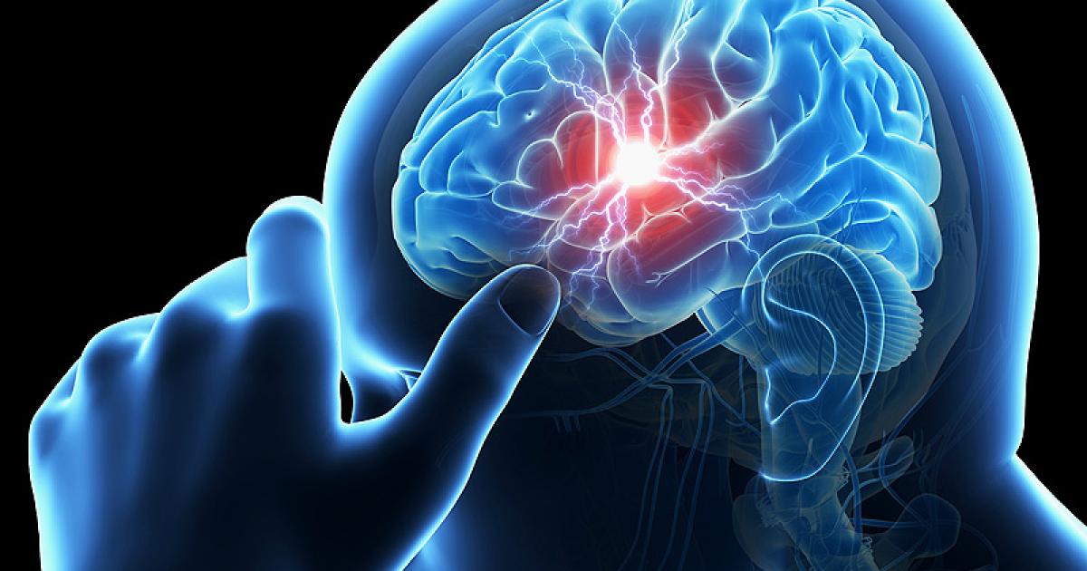 Treating And Preventing Cerebrovascular Disease - HealthPrep.com