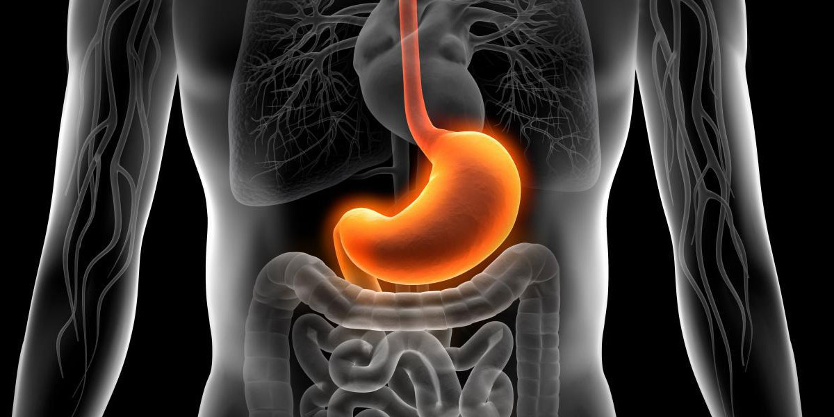 Causes Of Heartburn & Acid Reflux