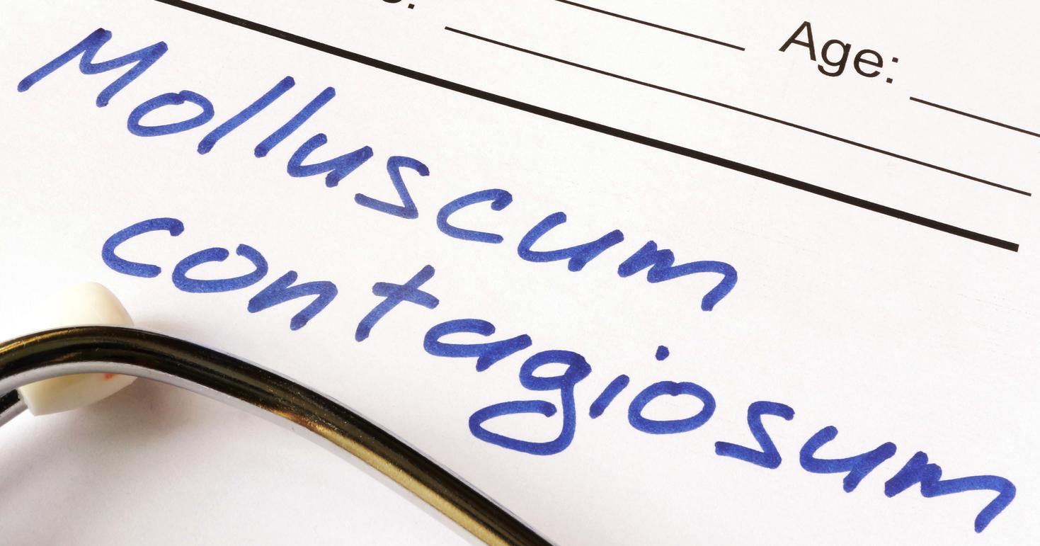 Warning Signs Of Molluscum Contagiosum HealthPrep