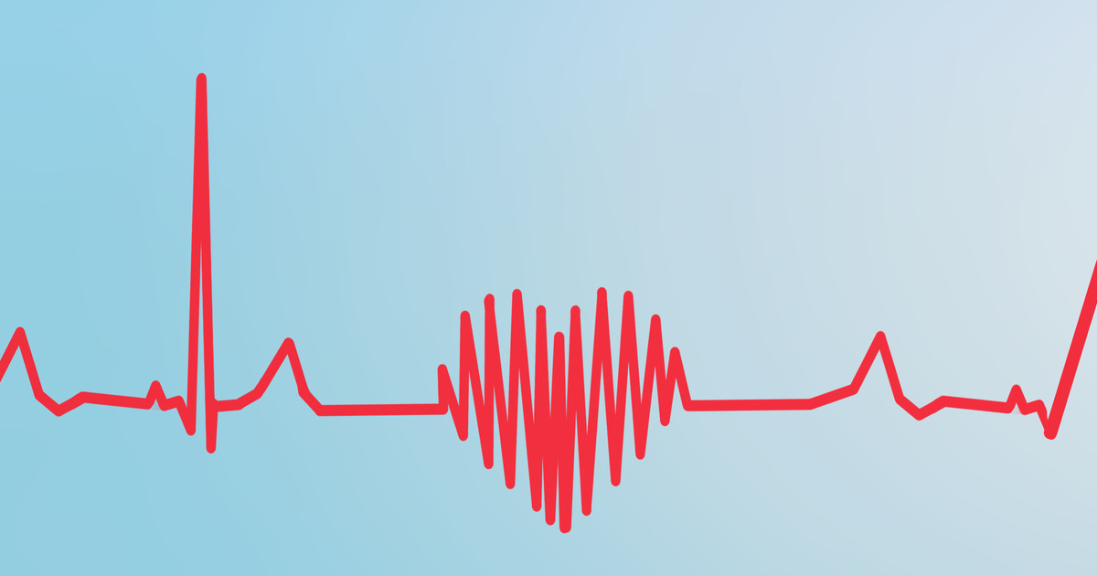 How To Lower Resting Heart Rate HealthPrep