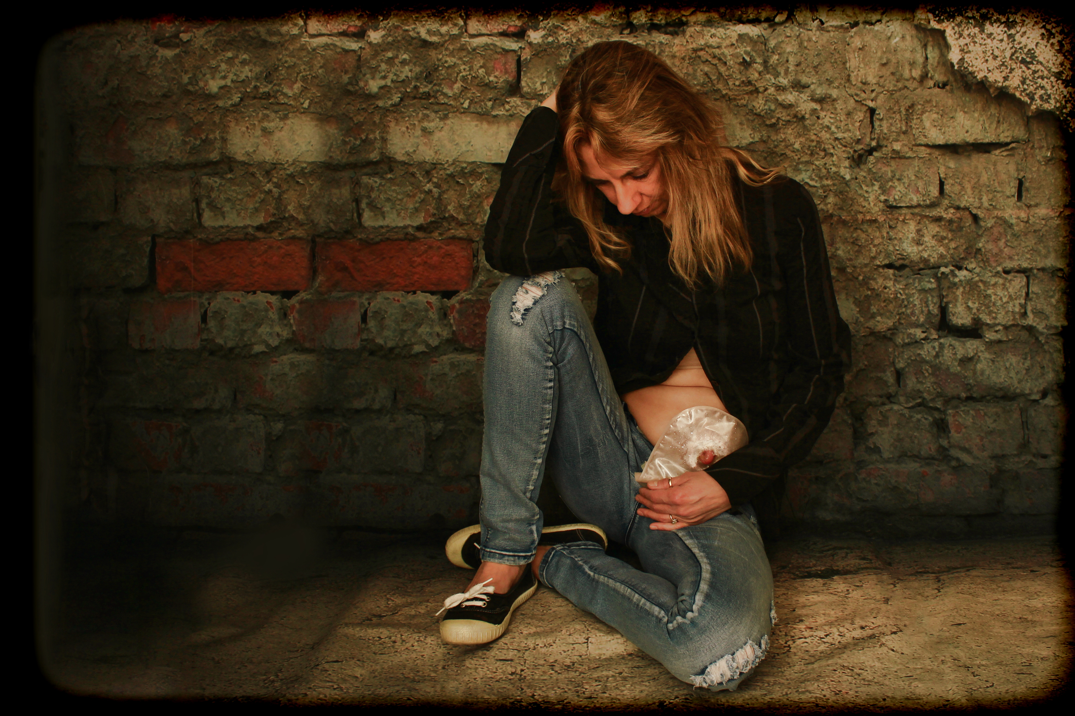 Woman With a Colostomy Bag