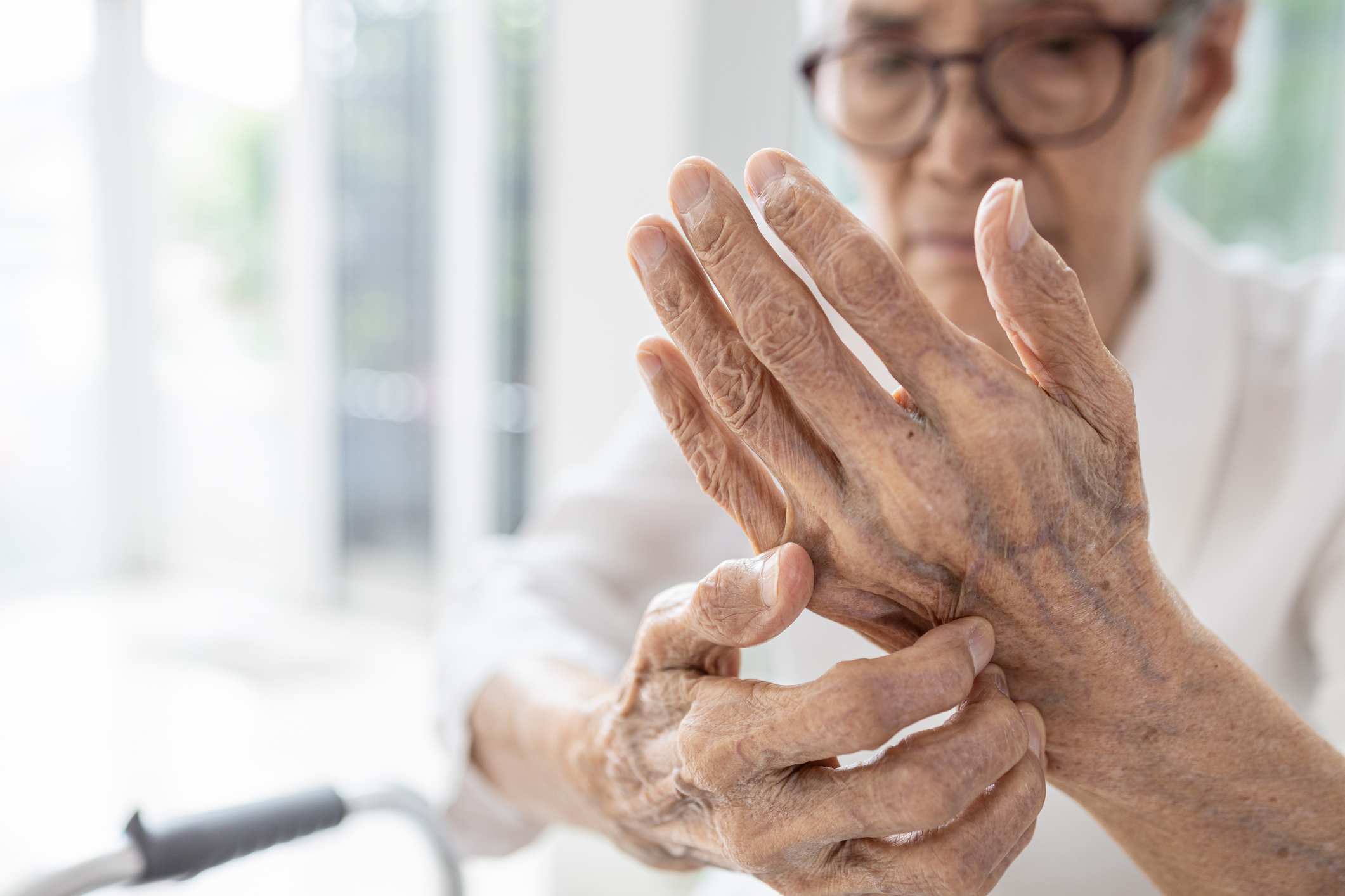 Understanding Psoriatic Arthritis Symptoms Diagnosis And Management